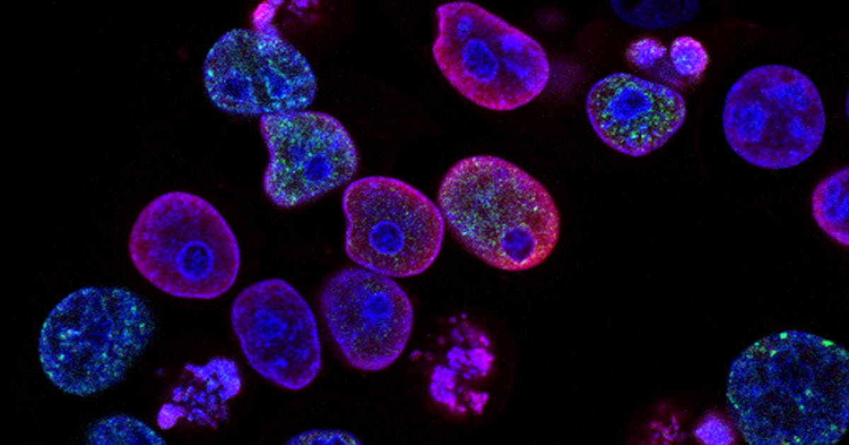 Alzheimer's & Dementia in India: Signs, Tests & Care