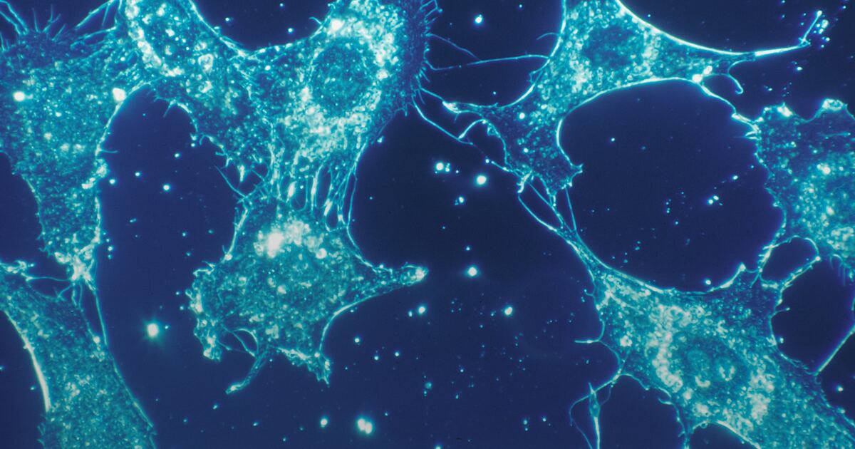 ANA Test: What a Positive Antinuclear Antibody Means