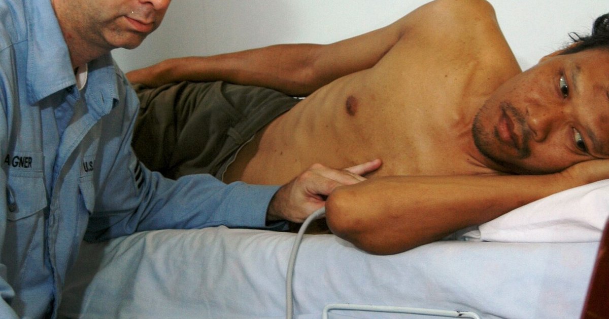 Heart Failure in India: Symptoms, Tests & Treatment