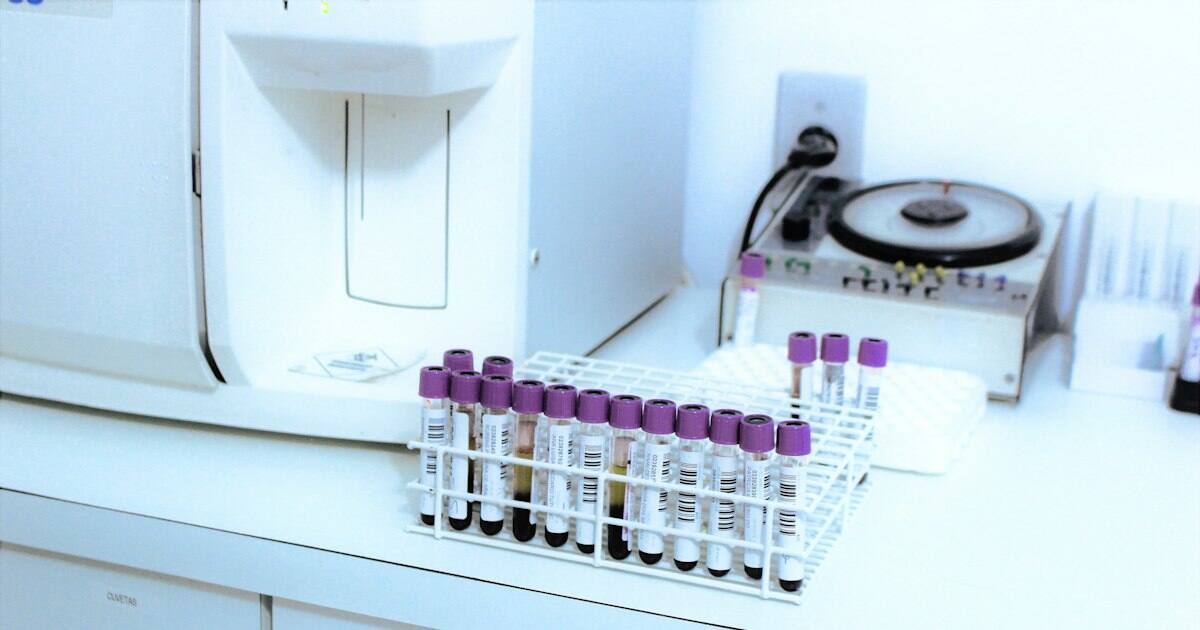 Low Platelet Count: What Your CBC Means (India Guide)