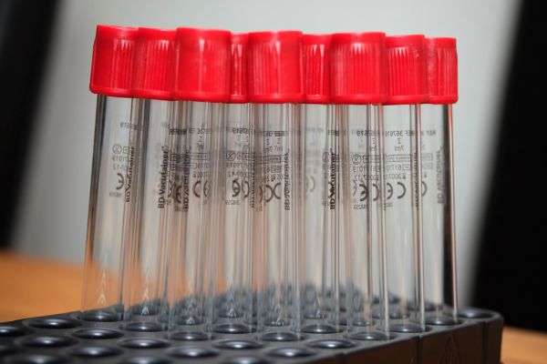 PT/INR Test: Blood Clotting Guide for Indians