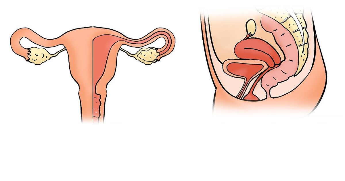 Uterine Fibroids in India: Symptoms, Tests & Treatment Guide