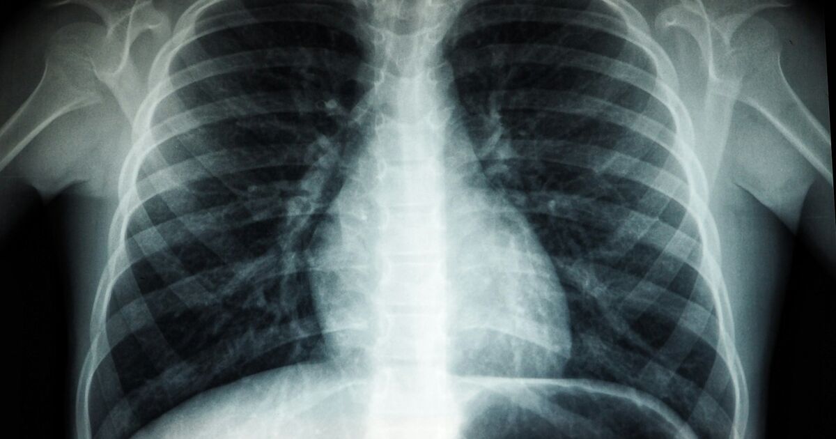 X-ray, CT Scan & MRI: A Complete Guide for Indians